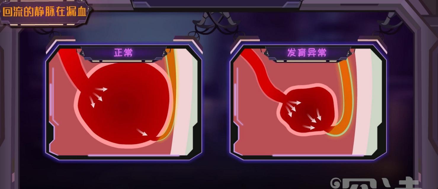 白掌叶子枯萎了怎么治疗？（有效的方法帮助白掌恢复健康）